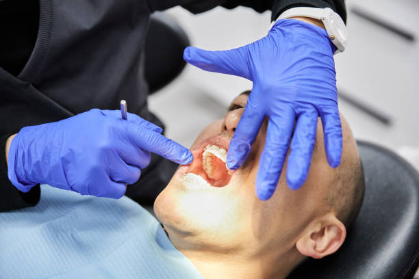 Best Emergency Dental Care for Sports Injuries in Urania, LA